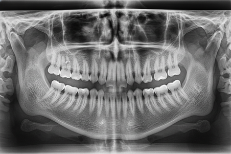 انواع عکس دندان