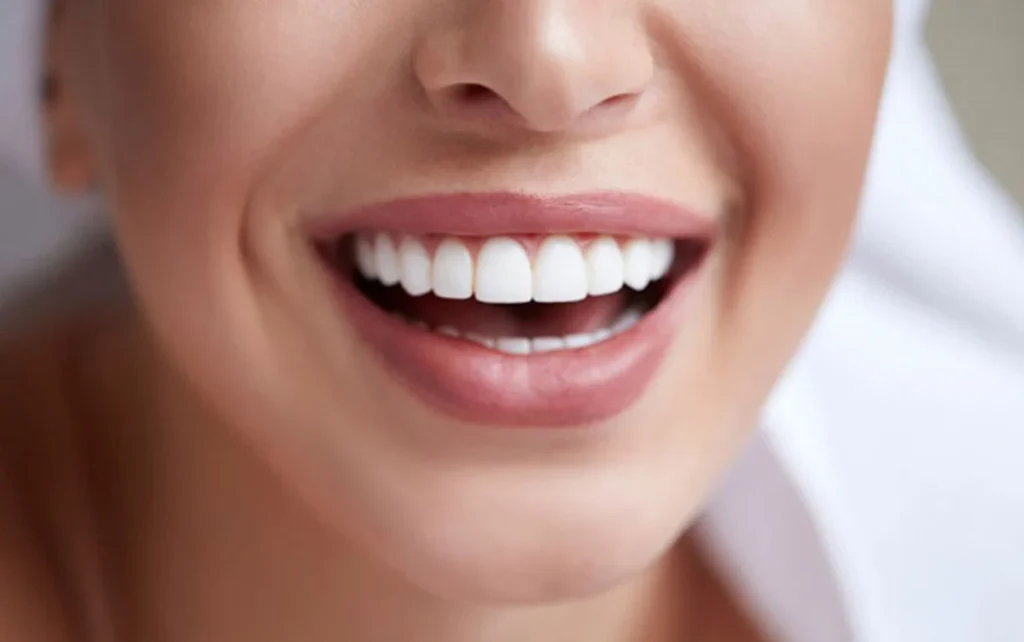 ایمپلنت فوری یا مرحله‌ای؟ بررسی مزایا و معایب هرکدام از نگاه متخصصان کاشان