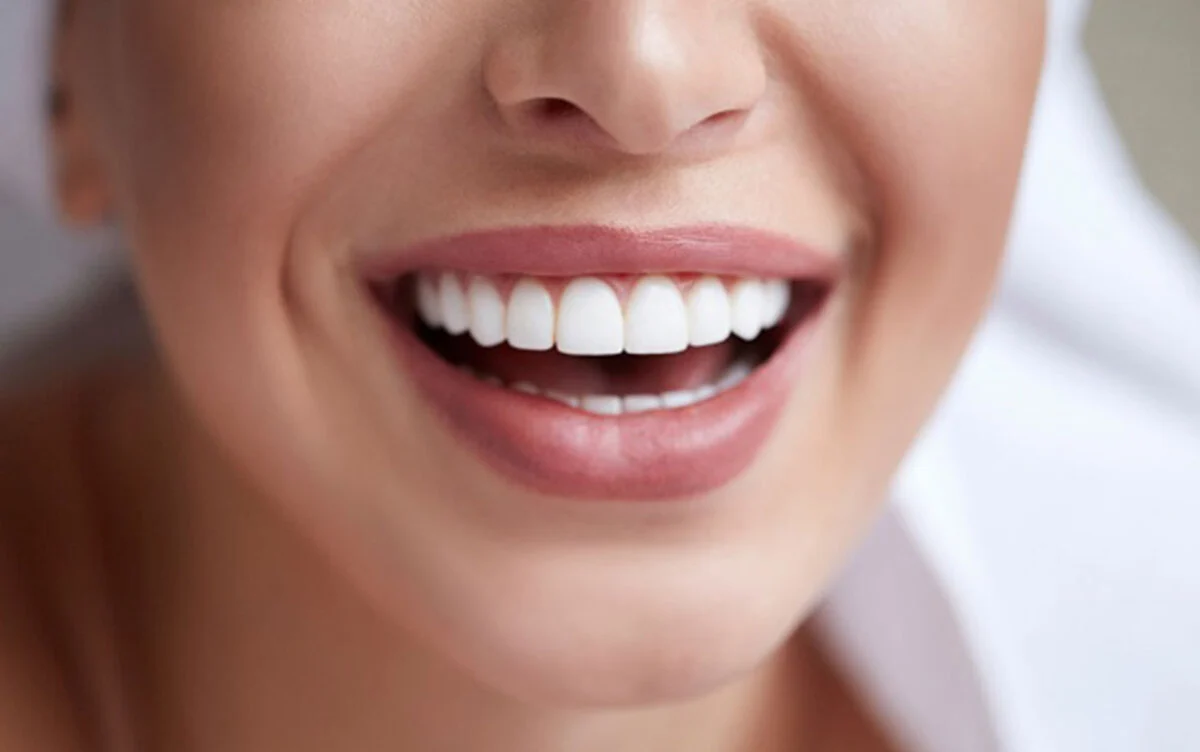 ایمپلنت فوری یا مرحله‌ای؟ بررسی مزایا و معایب هرکدام از نگاه متخصصان کاشان