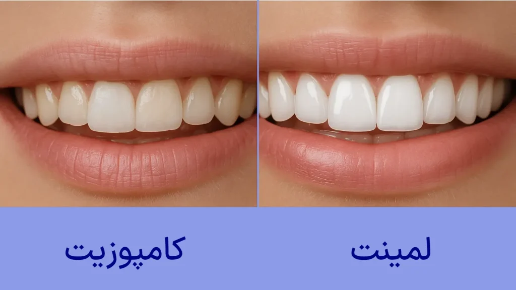 ایمپلنت فوری یا مرحله‌ای؟ بررسی مزایا و معایب هرکدام از نگاه متخصصان کاشان