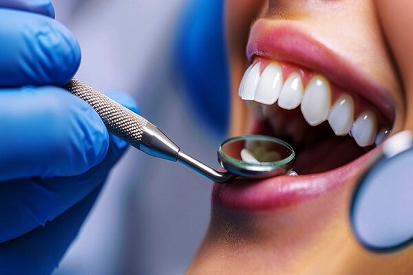 فیشورسیلانت چیست و چطور از پوسیدگی دندان کودکان جلوگیری میکند؟